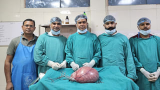 लोगों को लगा युवती प्रेग्नेंट है, सर्जरी हुई तो डॉक्टर भी हैरान, पेट से निकला 6.5 किलो का ट्यूमर