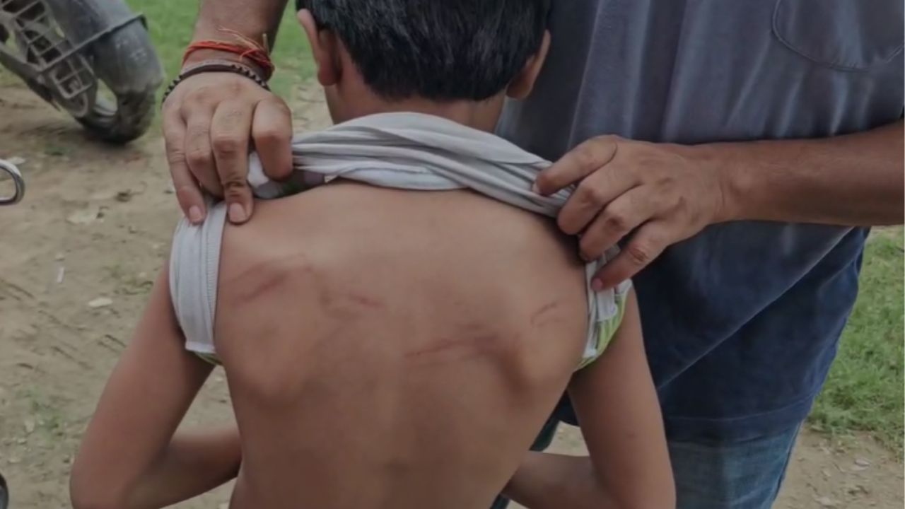 पेन से गोदा, प्लास्टिक की पाइप से पीटा; होमवर्क पूरा ना होने पर टीचर ने की रूह कंपाने वाली हैवानियत पेन से गोदा, प्लास्टिक की पाइप से पीटा; होमवर्क पूरा ना होने पर टीचर ने की रूह कंपाने वाली हैवानियत