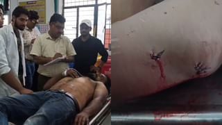 चाकूबाज पत्नी की करतूत, प्रेमी के साथ पकड़ी गई तो पति को कर दिया लहूलुहान