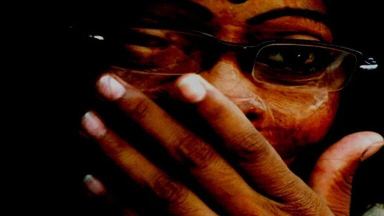 10 लाख दहेज नहीं दिया तो दामाद ने पत्नी सहित सास और साले पर फेंका एसिड