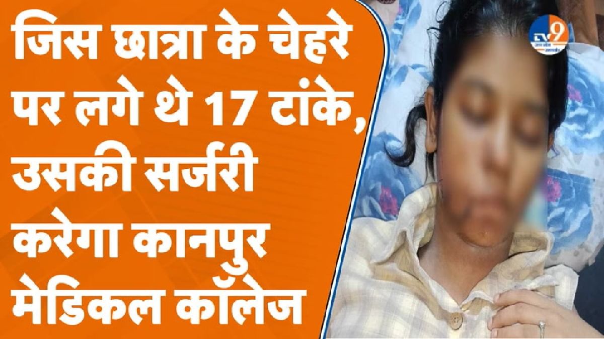 कानपुर मेडिकल कॉलेज करेगा BBA छात्रा की प्लास्टिक सर्जरी, कुत्तों ने किया था हमला