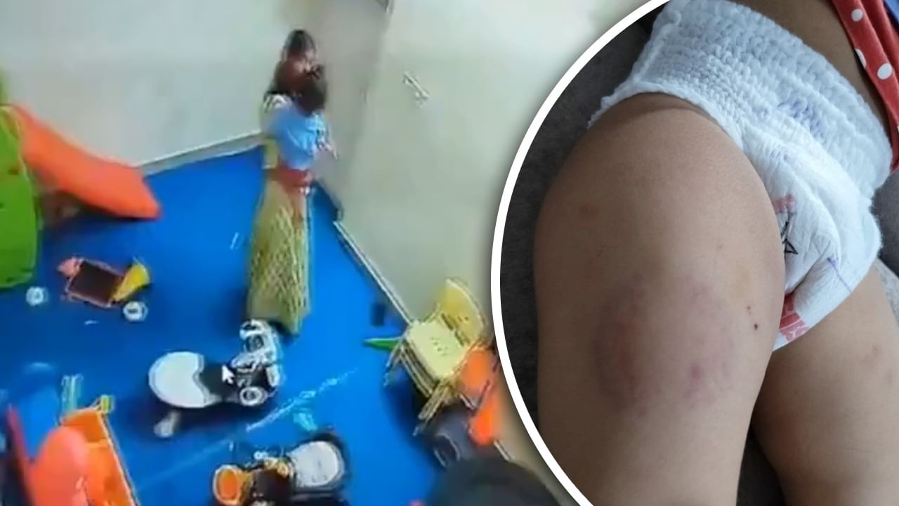 नोएडा: दांत से काटा, थप्पड़ मारकर जमीन पर पटका; 15 महीने की बच्ची संग केयर टेकर ने की बर्बरता नोएडा: दांत से काटा, थप्पड़ मारकर जमीन पर पटका; 15 महीने की बच्ची संग केयर टेकर ने की बर्बरता