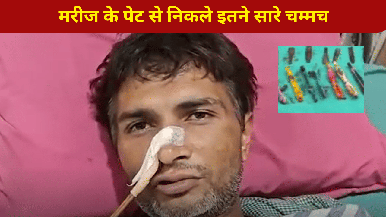 अरे बाप रे! युवक के पेट से निकले 29 स्टील चम्मच, 19 टूथब्रश, 2 पेन… डॉक्टर भी रह गए दंग