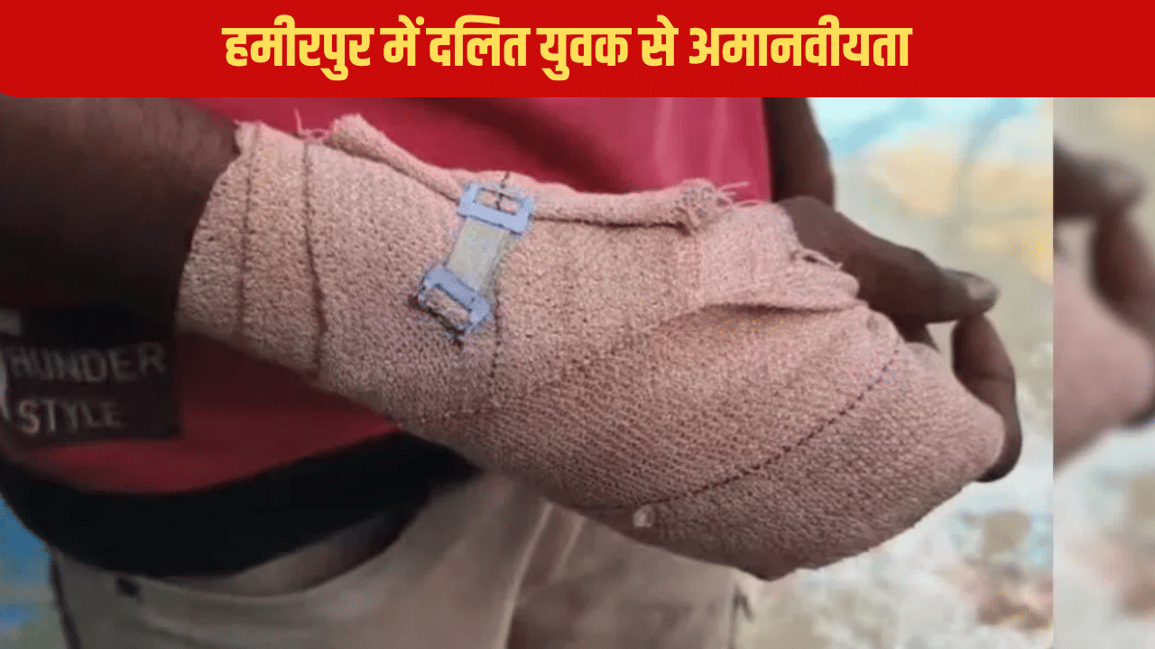 गालियां दी, जूते चटवाए फिर पीट-पीटकर तोड़ दिया हाथ… हमीरपुर में दलित युवक के साथ अमानवीयता गालियां दी, जूते चटवाए फिर पीट-पीटकर तोड़ दिया हाथ… हमीरपुर में दलित युवक के साथ अमानवीयता