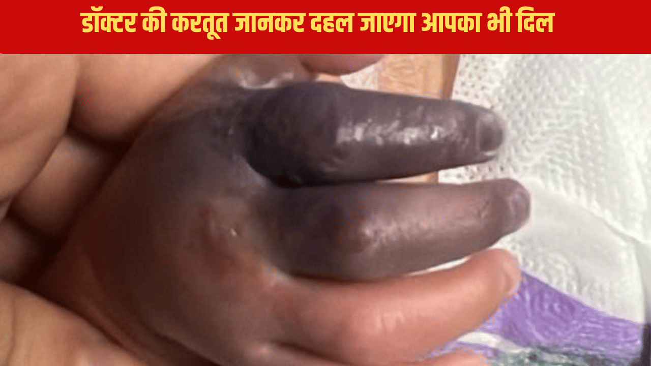 काटनी पड़ जाएगी बच्ची की हथेली, डॉक्टर की ऐसी करतूत जान दहल जाएगा दिल