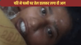 कैरोसिन डाला, फिर लगा दी बीवी को आग… विवाहिता ने कपड़े फाड़कर बचाई जान, वीडियो में बताई पति की करतूत