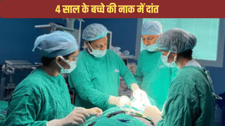 अरे बाप रे! बच्चे की नाक में उग आया दांत, रिपोर्ट देखकर डॉक्टर भी हैरान