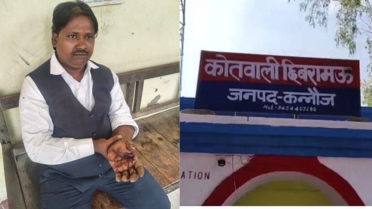 पड़ोसी के टॉयलेट में चला गया था बाराती, लोगों ने पीट-पीटकर किया ये हाल