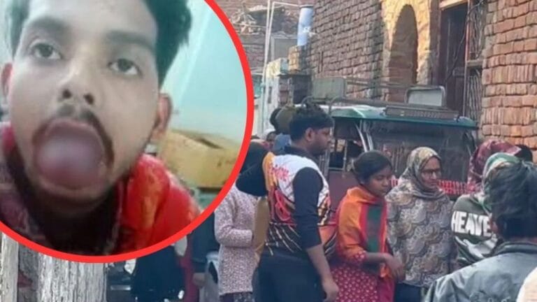 खाना बनाने को लेकर बवाल, पत्नी ने दांतों से काट डाली पति की पूरी जीभ