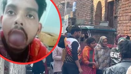 खाना बनाने को लेकर बवाल, पत्नी ने दांतों से काट डाली पति की पूरी जीभ