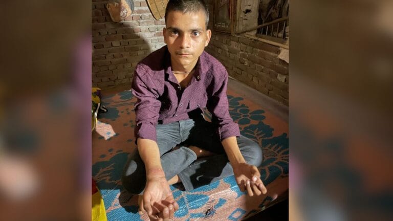 छात्र पर टूटा पुलिसया कहर! रिश्वत ना देने पर चौकी में दी थर्ड डिग्री