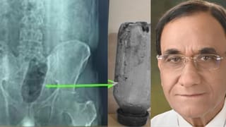 युवक पर चढ़ी ऐसी सनक, अपने ही निजी अंग में डाल दी पानी की बोतल