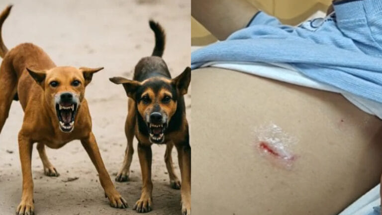 ग्रेटर नोएडा में आवारा कुत्तों का आतंक, पूर्व  अधिकारी को 13 जगह काटा