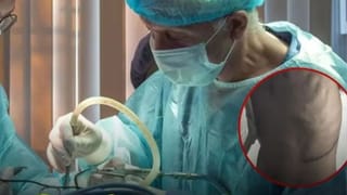 UPI पेमेंट के चलते पकड़े गए आरोपी…किडनी ट्रांसप्लांट के पैसों से दमन-दीव ट्रिप का कर रहे थे प्लान