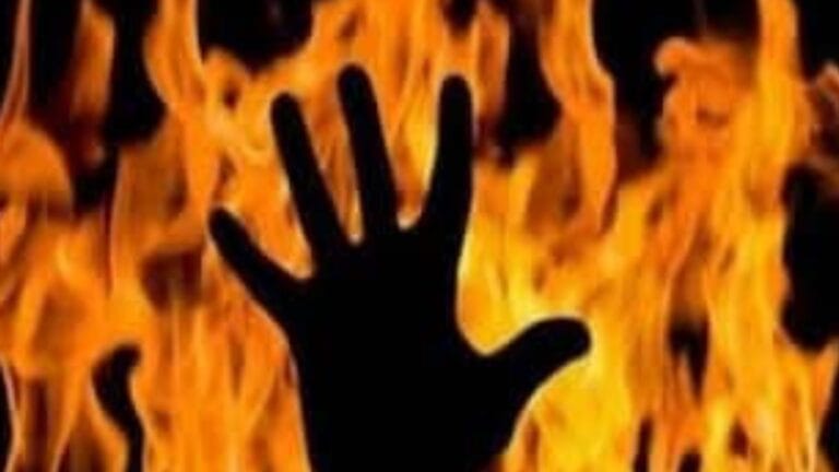 बच्चा ना होने की ऐसी सजा… बहू को आग में झोंका, फिर फरार हो गए ससुराली