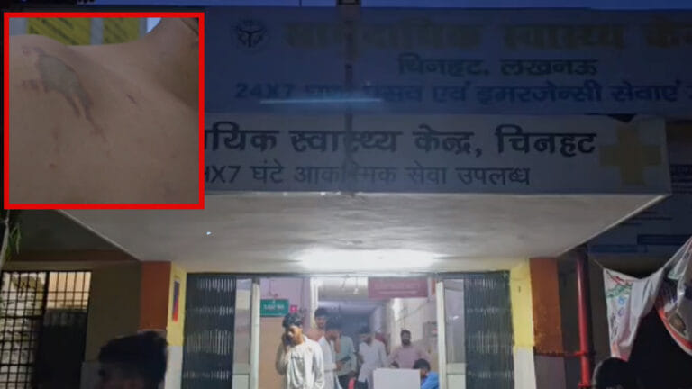 लखनऊ में सोलर कारोबारी पर जानलेवा हमला, दुकान में घुसकर एसिड से हमला