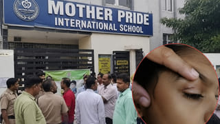 LKG छात्र की आंख में पेंसिल घोंपा, बड़े भाई की भी पिटाई… स्कूल के निदेशक समेत 4 पर FIR