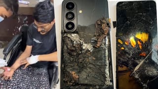 जेब में हुआ मोबाइल ब्लास्ट, जल गए युवक के दोनों हाथ और प्राइवेट पार्ट