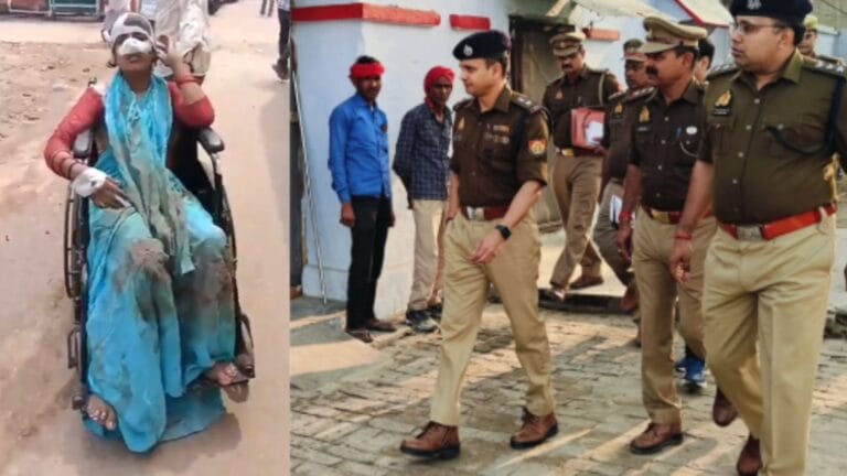 पति ने काटी नाक, पत्नी का गुप्तांग पर हमला; हसबैंड-वाइफ की हैवानियत